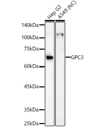 Glypican 3 (GPC3) Rabbit Polyclonal Antibody