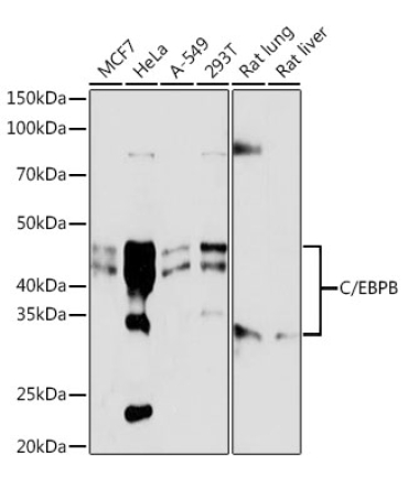 C/EBPB Rabbit Monoclonal Antibody