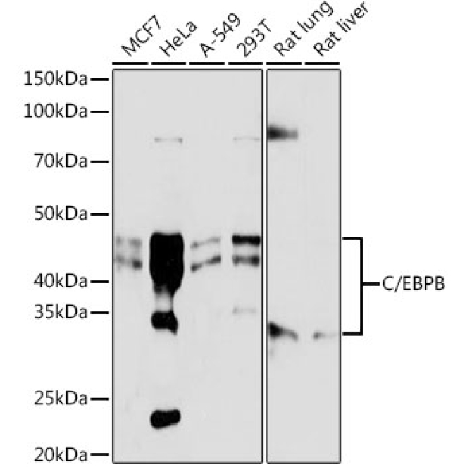 C/EBPB Rabbit Monoclonal Antibody
