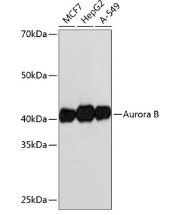 Aurora B Rabbit Monoclonal Antibody