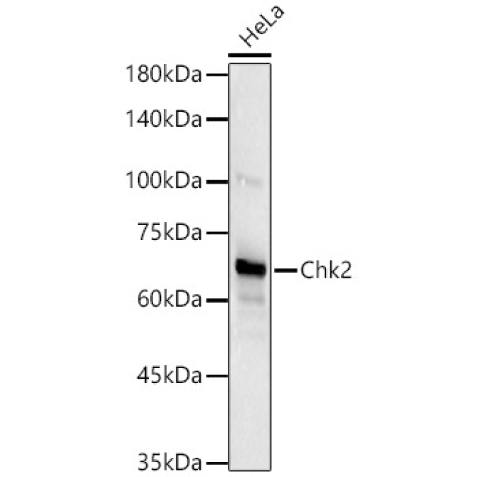 Chk2 Rabbit Monoclonal Antibody