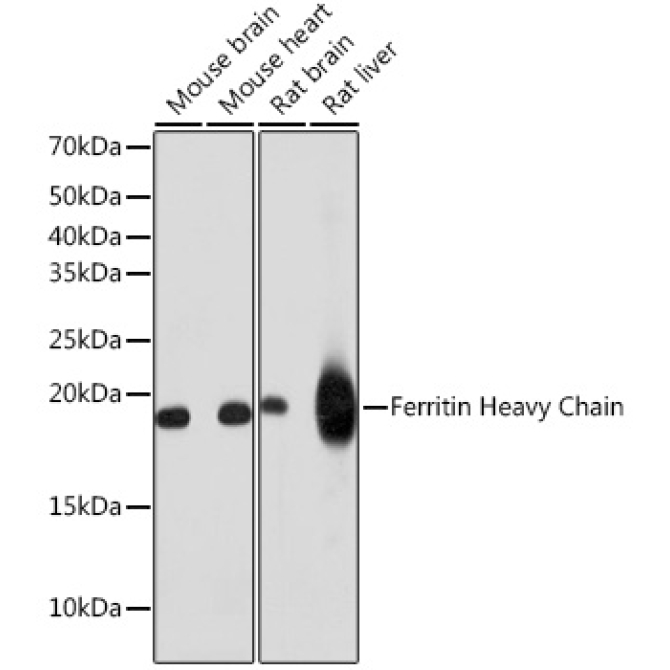Ferritin Heavy Chain Rabbit Monoclonal Antibody