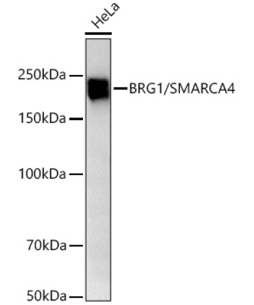 BRG1/SMARCA4 Rabbit Monoclonal Antibody