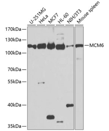 MCM6 Rabbit Polyclonal Antibody
