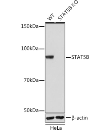 STAT5B Rabbit Monoclonal Antibody [KO Validated]