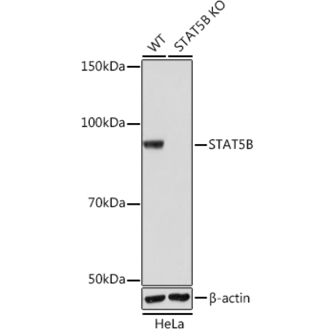 STAT5B Rabbit Monoclonal Antibody [KO Validated]