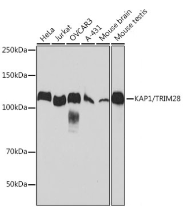 KAP1/TRIM28 Rabbit Monoclonal Antibody