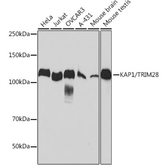 KAP1/TRIM28 Rabbit Monoclonal Antibody
