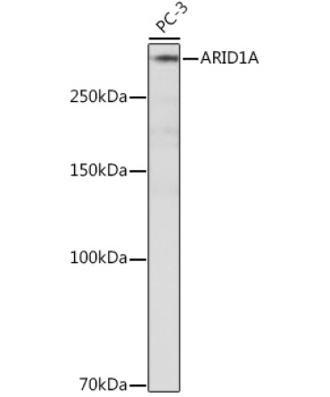 ARID1A Rabbit Monoclonal Antibody