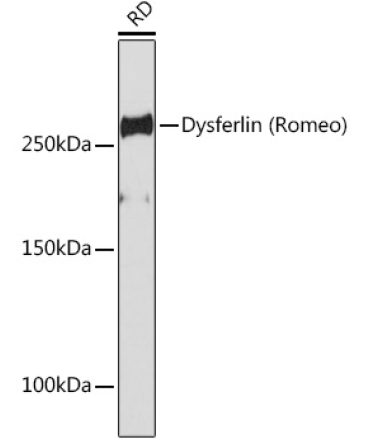 Dysferlin Rabbit Monoclonal Antibody