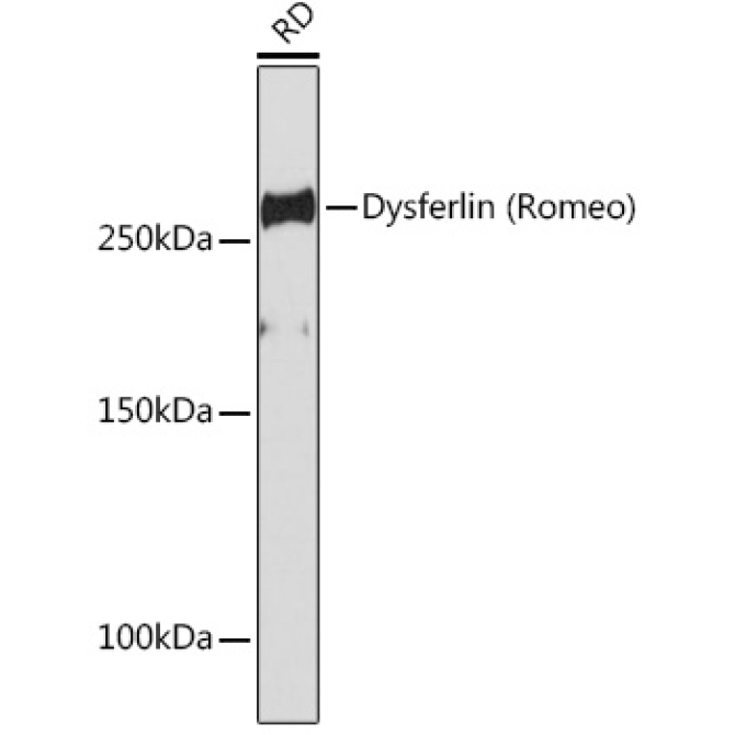 Dysferlin Rabbit Monoclonal Antibody