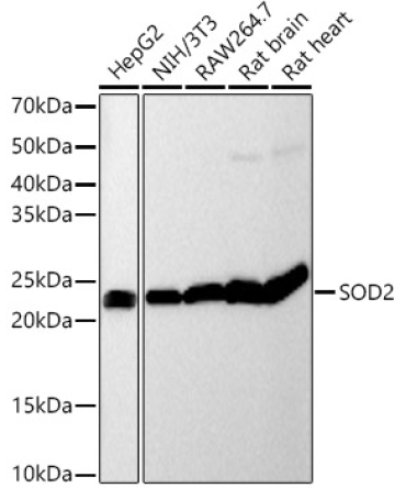 SOD2 Rabbit Monoclonal Antibody [KO Validated]