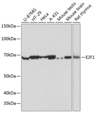 E2F1 Rabbit Monoclonal Antibody