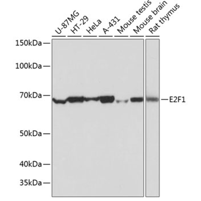E2F1 Rabbit Monoclonal Antibody