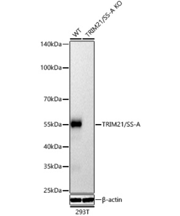 TRIM21/SS-A Rabbit Polyclonal Antibody [KD Validated]