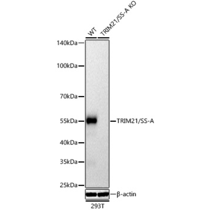 TRIM21/SS-A Rabbit Polyclonal Antibody [KD Validated]