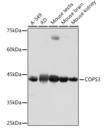 COPS3 Rabbit Monoclonal Antibody