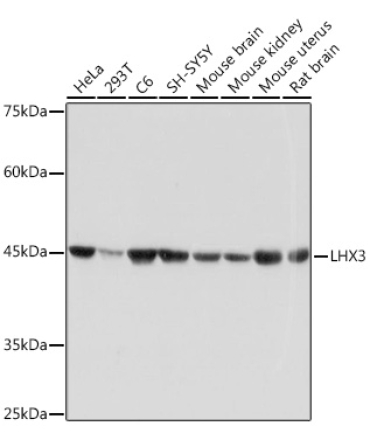 LHX3 Rabbit Monoclonal Antibody