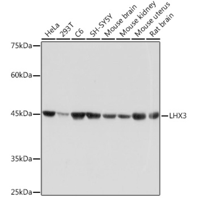 LHX3 Rabbit Monoclonal Antibody