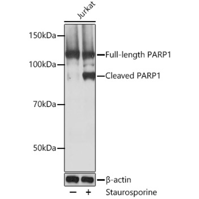 PARP1 Rabbit Monoclonal Antibody