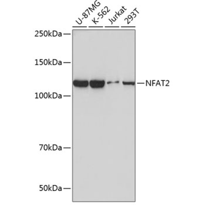 NFAT2 Rabbit Monoclonal Antibody