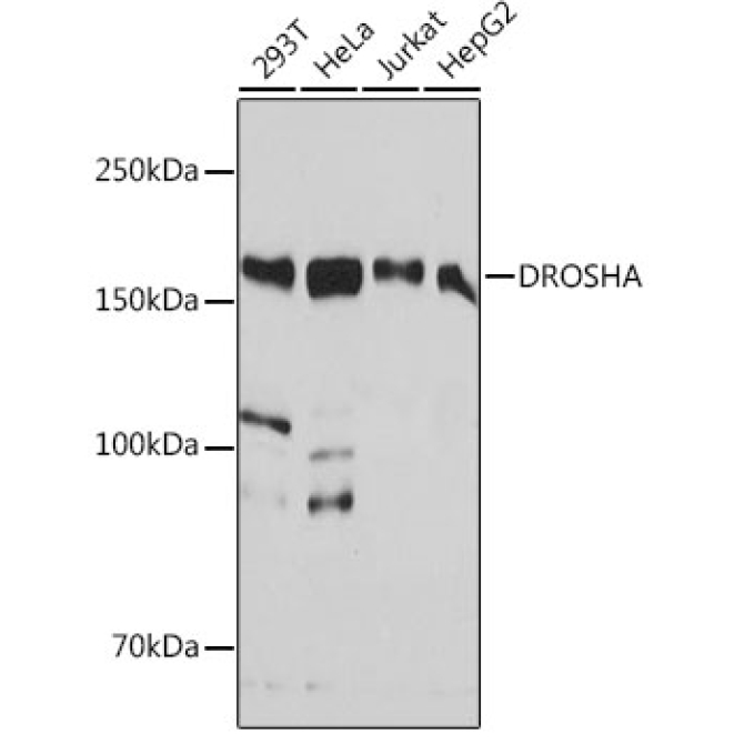 DROSHA Rabbit Monoclonal Antibody