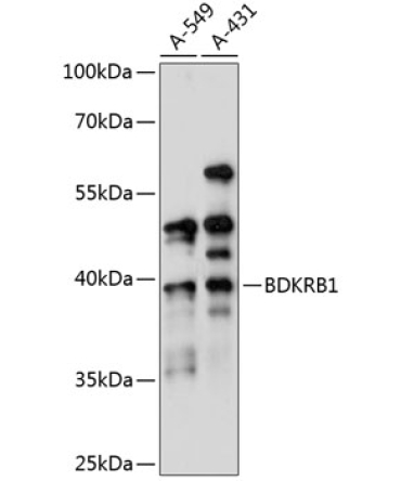 BDKRB1 Rabbit Polyclonal Antibody