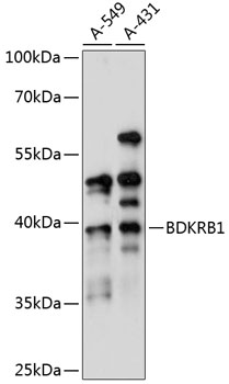 BDKRB1 Rabbit Polyclonal Antibody