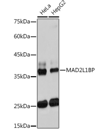 MAD2L1BP Rabbit Monoclonal Antibody