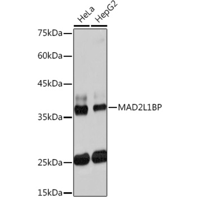 MAD2L1BP Rabbit Monoclonal Antibody
