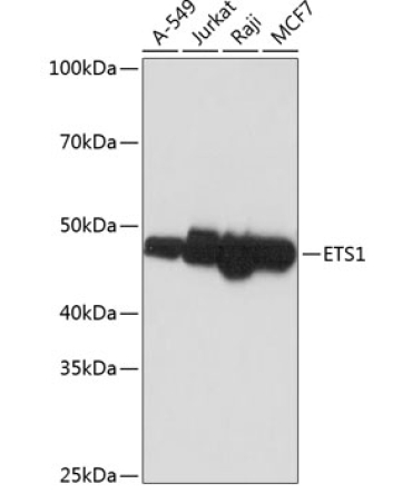 ETS1 Rabbit Monoclonal Antibody