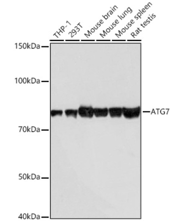 ATG7 Rabbit Monoclonal Antibody [KD Validated]