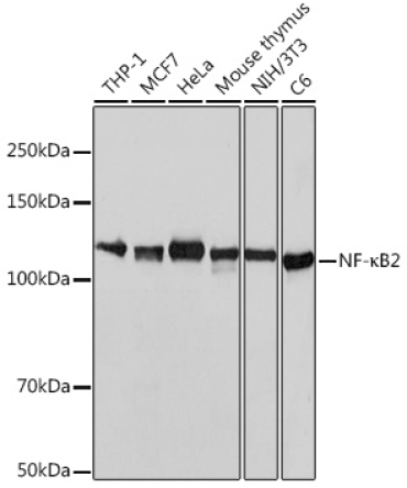 NF-?B2 Rabbit Monoclonal Antibody