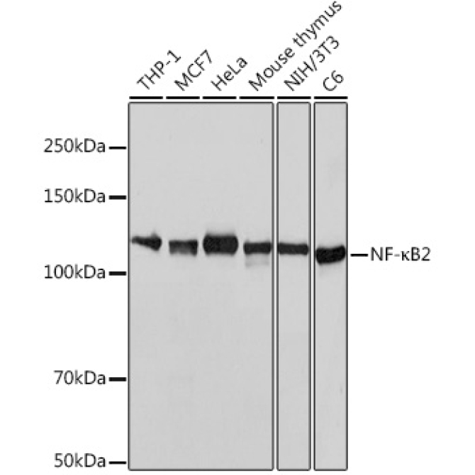 NF-?B2 Rabbit Monoclonal Antibody