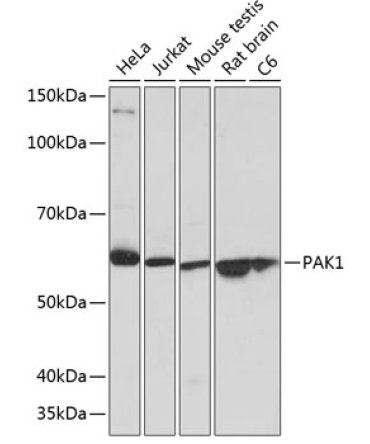 PAK1 Rabbit Monoclonal Antibody