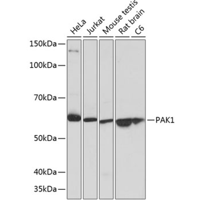 PAK1 Rabbit Monoclonal Antibody