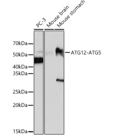 ATG12 Rabbit Monoclonal Antibody