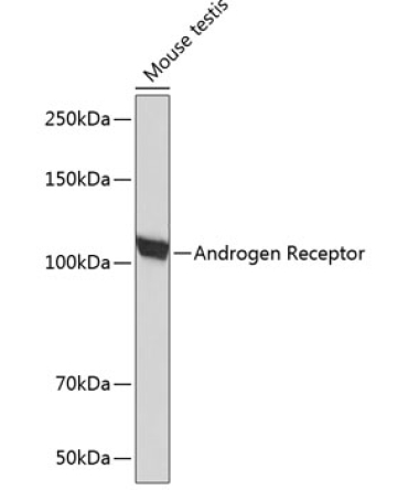 Androgen Receptor Rabbit Monoclonal Antibody