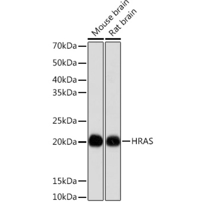 HRAS Rabbit Monoclonal Antibody