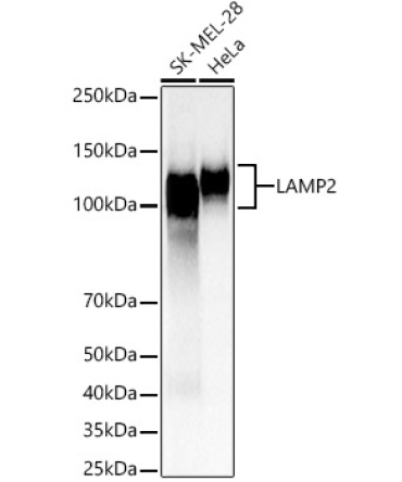 LAMP2 Rabbit Polyclonal Antibody