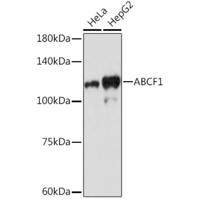 ABCF1 Rabbit Monoclonal Antibody