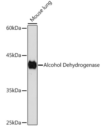 Alcohol Dehydrogenase Rabbit Monoclonal Antibody