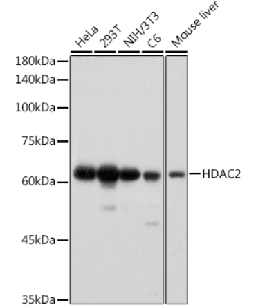 HDAC2 Rabbit Monoclonal Antibody