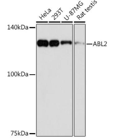 ABL2 Rabbit Monoclonal Antibody