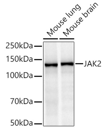 JAK2 Rabbit Monoclonal Antibody