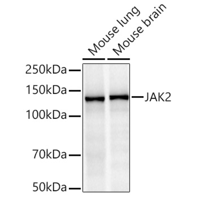 JAK2 Rabbit Monoclonal Antibody