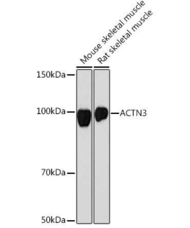 ACTN3 Rabbit Monoclonal Antibody