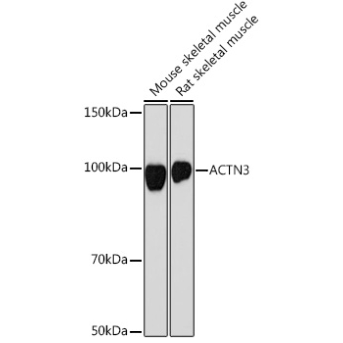 ACTN3 Rabbit Monoclonal Antibody