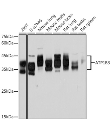 ATP1B3 Rabbit Monoclonal Antibody