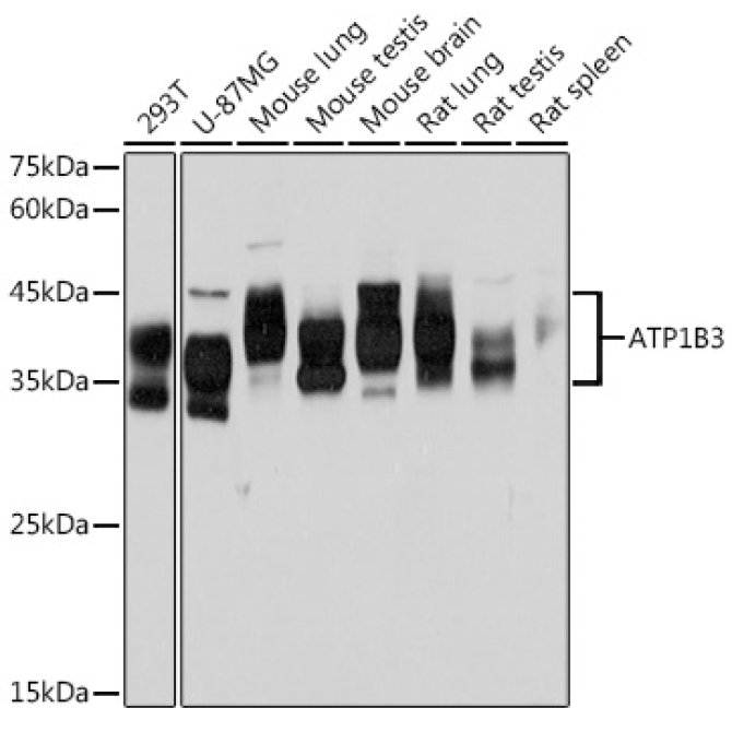 ATP1B3 Rabbit Monoclonal Antibody